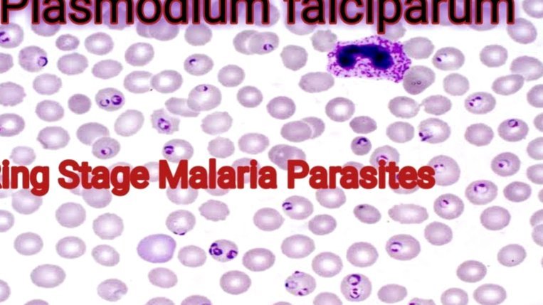 曼城或迎阿兰，转会费或达4000万欧